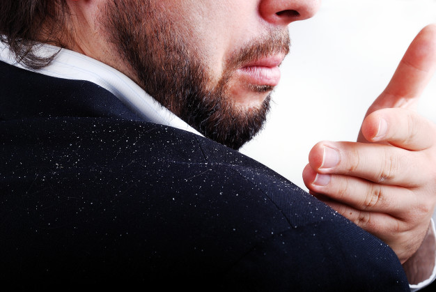 Dandruff - Can  Ayurvedic Remedies Help  Treating It??